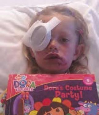 Missty Gamblin, 5 (previous photo) with a ladybug painted on her cheek and (above) in the hospital after a dog bite that required plastic surgery on her cheek and eye. The dog is quarantined.